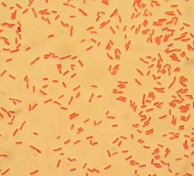 E.coli en orina
